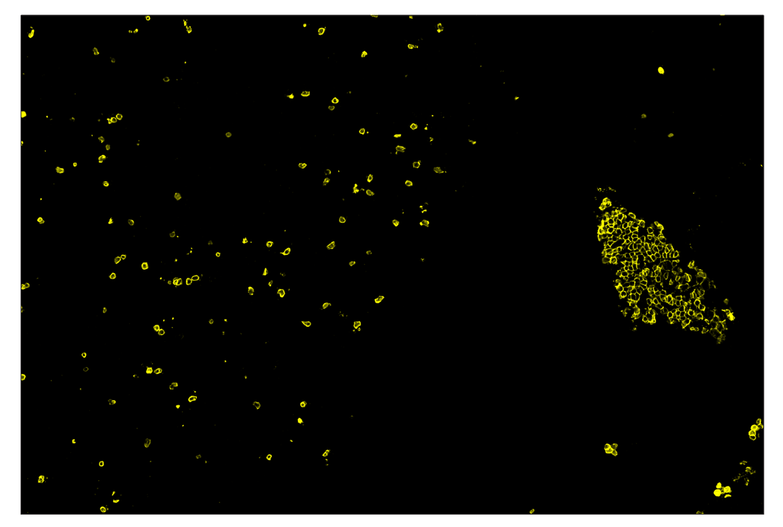 Immunohistochemistry Image 3: CD20 (E3N7O) & CO-0134-594 SignalStar<sup>™</sup> Oligo-Antibody Pair