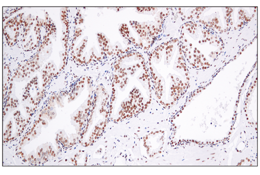 Immunohistochemistry Image 4: ATF-2/ATF-7 (A9G1M) Rabbit Monoclonal Antibody