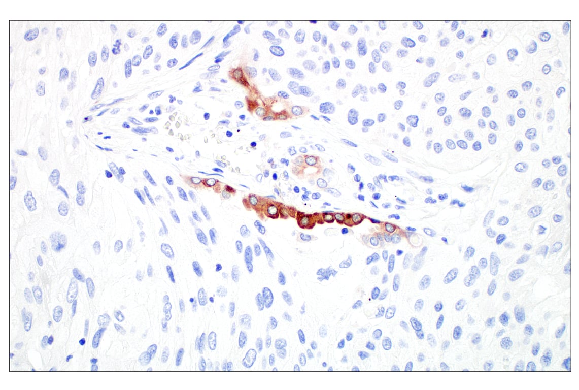Immunohistochemistry Image 4: LPCAT1 (E4V4B) Rabbit Monoclonal Antibody (BSA and Azide Free)