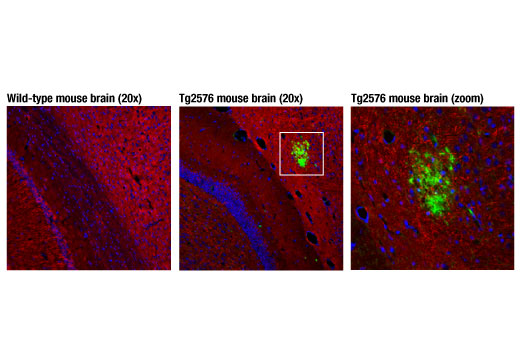 Immunofluorescence Image 1: beta-Amyloid (D3D2N) Mouse Monoclonal Antibody