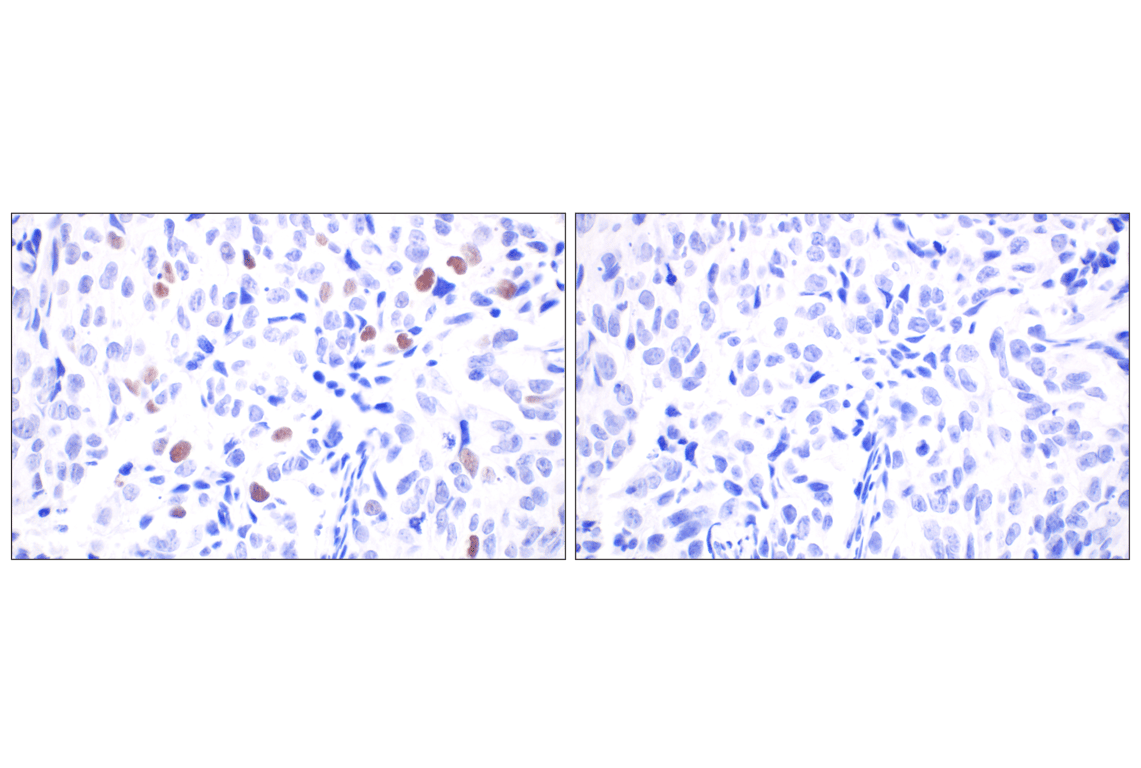 undefined Image 12: PhosphoPlus<sup>®</sup> DNA-PKcs (Ser2056) Antibody Duet