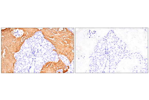 Immunohistochemistry Image 5: Fibrinogen gamma chain (E1U3Z) Rabbit Monoclonal Antibody (BSA and Azide Free)