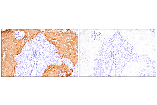 Immunohistochemistry Image 5: Fibrinogen gamma chain (E1U3Z) XP<sup>®</sup> Rabbit mAb (BSA and Azide Free)