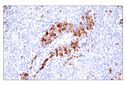 Virus / Infection CD 新品・未開封 CD22 (E7L6Z) XP® Rabbit mAb | Cell Signaling Technology