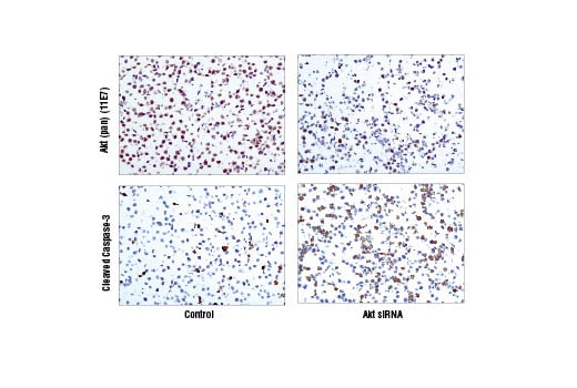 Immunohistochemistry Image 5: Akt (pan) (11E7) Rabbit Monoclonal Antibody