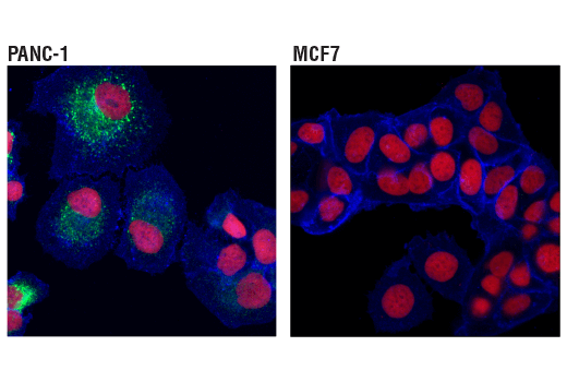 Immunofluorescence Image 1: CTGF (D8Z8U) Rabbit Monoclonal Antibody (BSA and Azide Free)