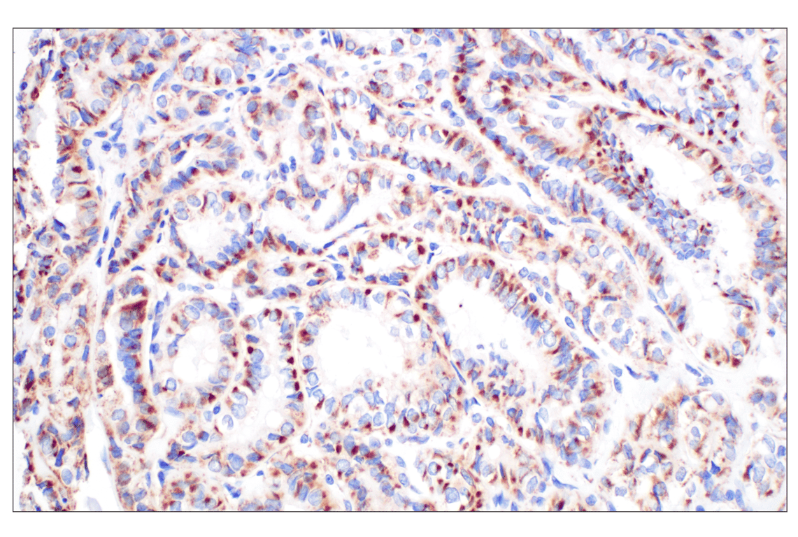 Immunohistochemistry Image 3: GCDH (F2P2M) Rabbit Monoclonal Antibody