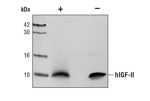 undefined Image 2: Human Insulin-like Growth Factor II (hIGF-II)
