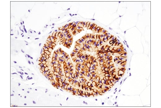 Immunohistochemistry Image 2: EpCAM (E6V8Y) Rabbit Monoclonal Antibody (BSA and Azide Free)