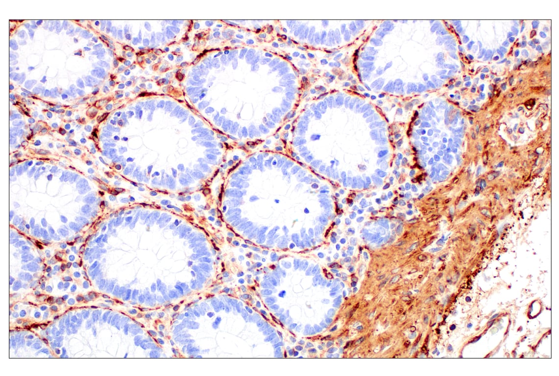 Immunohistochemistry Image 6: Filamin A (E8P8M) Rabbit Monoclonal Antibody