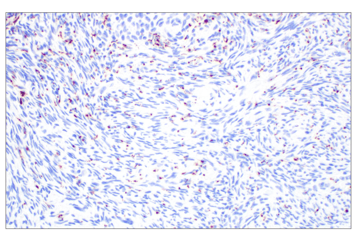 Immunohistochemistry Image 6: GAP43 (E6L2W) Mouse Monoclonal Antibody
