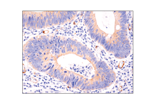 Immunohistochemistry Image 1: FAK (D5O7U) Rabbit Monoclonal Antibody (BSA and Azide Free)