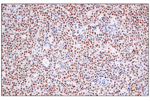 Immunohistochemistry Image 2: ATF-2/ATF-7 (A9G1M) Rabbit Monoclonal Antibody