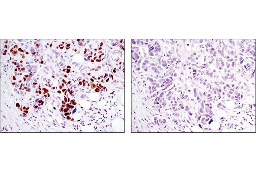 Immunohistochemistry Image 2: Phospho-Rb (Ser807/811) (D20B12) Rabbit Monoclonal Antibody (BSA and Azide Free)