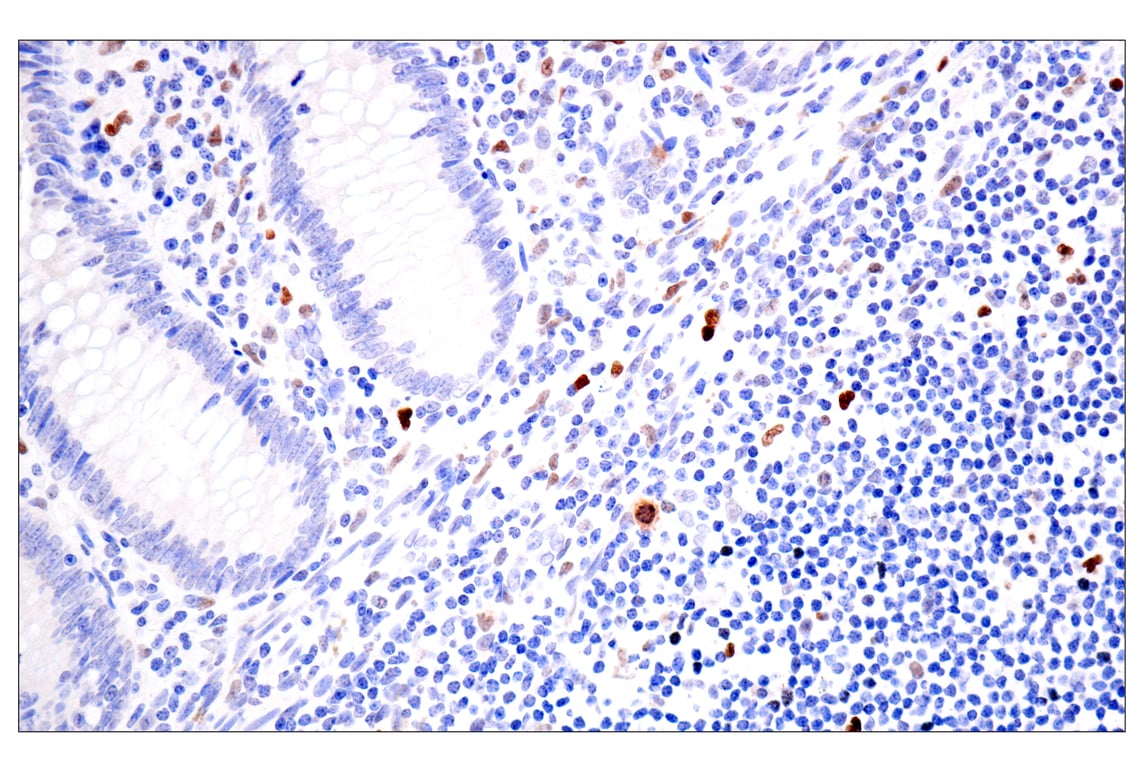 Immunohistochemistry Image 10: BATF3 (E3F3L) Rabbit Monoclonal Antibody