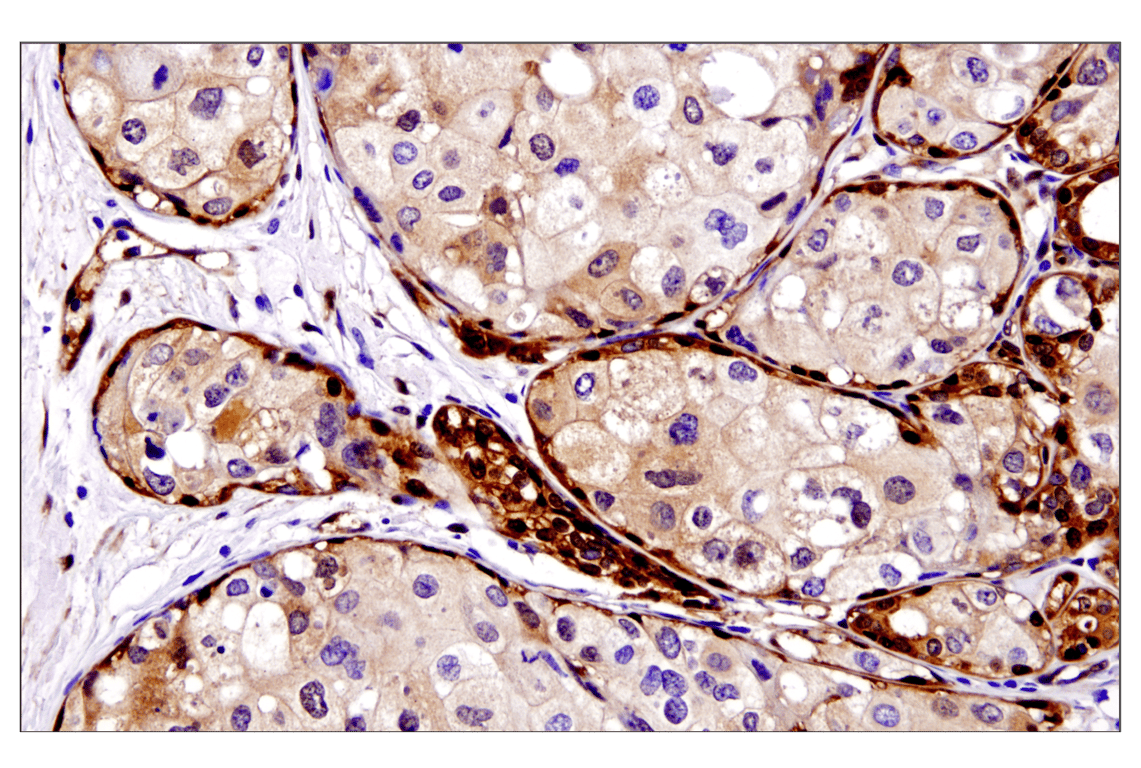 Immunohistochemistry Image 2: YAP (D8H1X) Rabbit Monoclonal Antibody