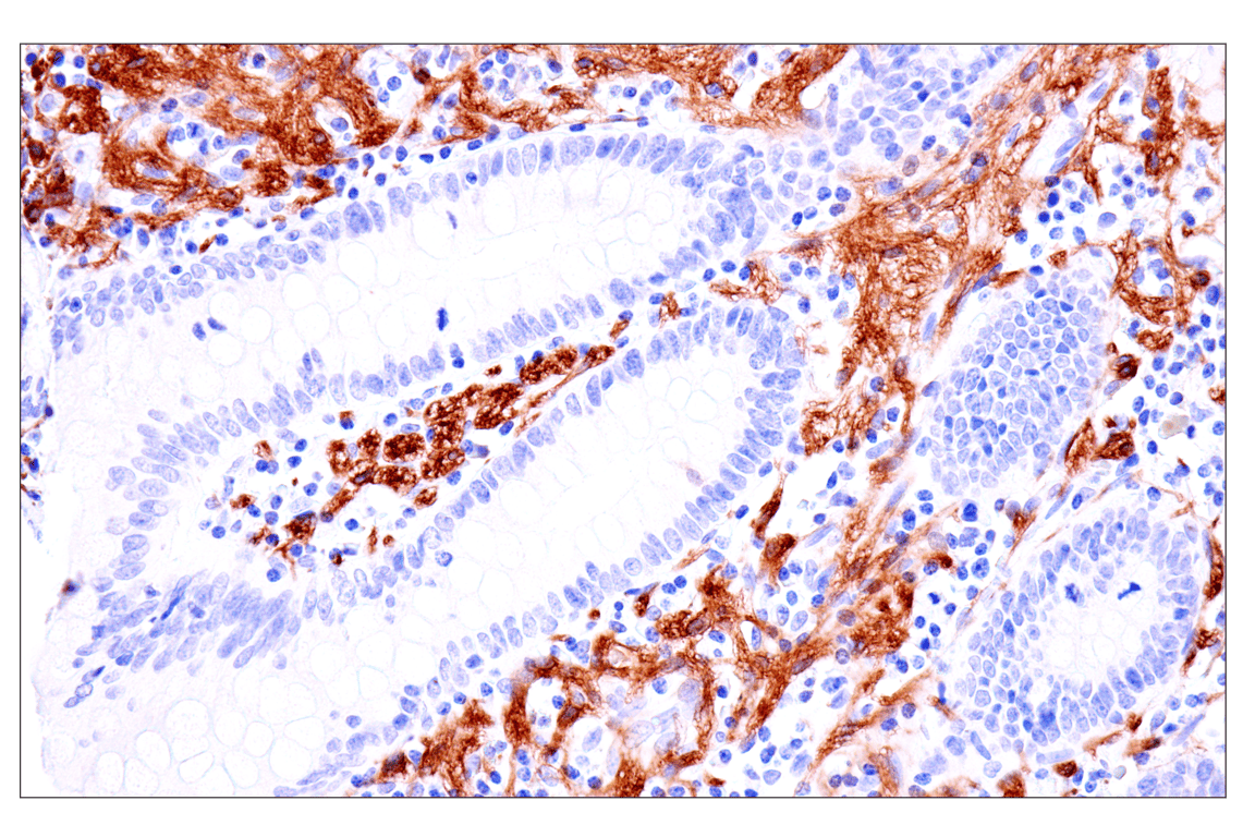 Immunohistochemistry Image 13: p75NTR (E7I3M) Rabbit Monoclonal Antibody (BSA and Azide Free)