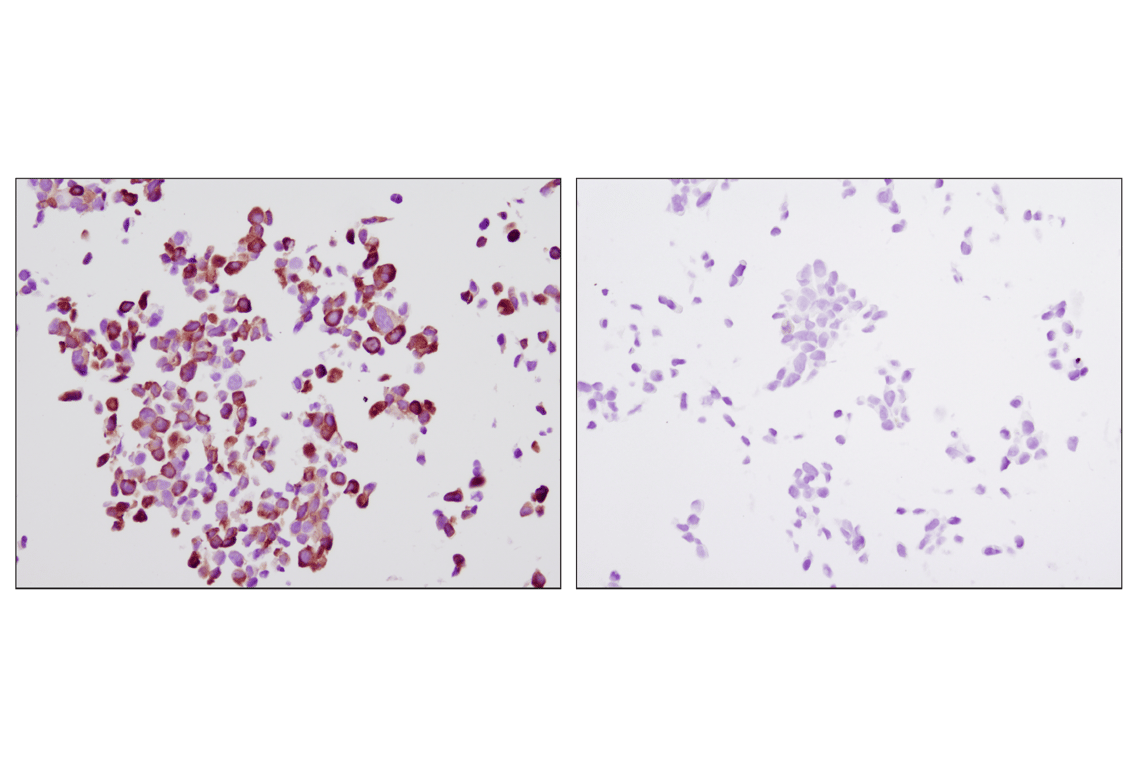 undefined Image 40: Translational Control Antibody Sampler Kit