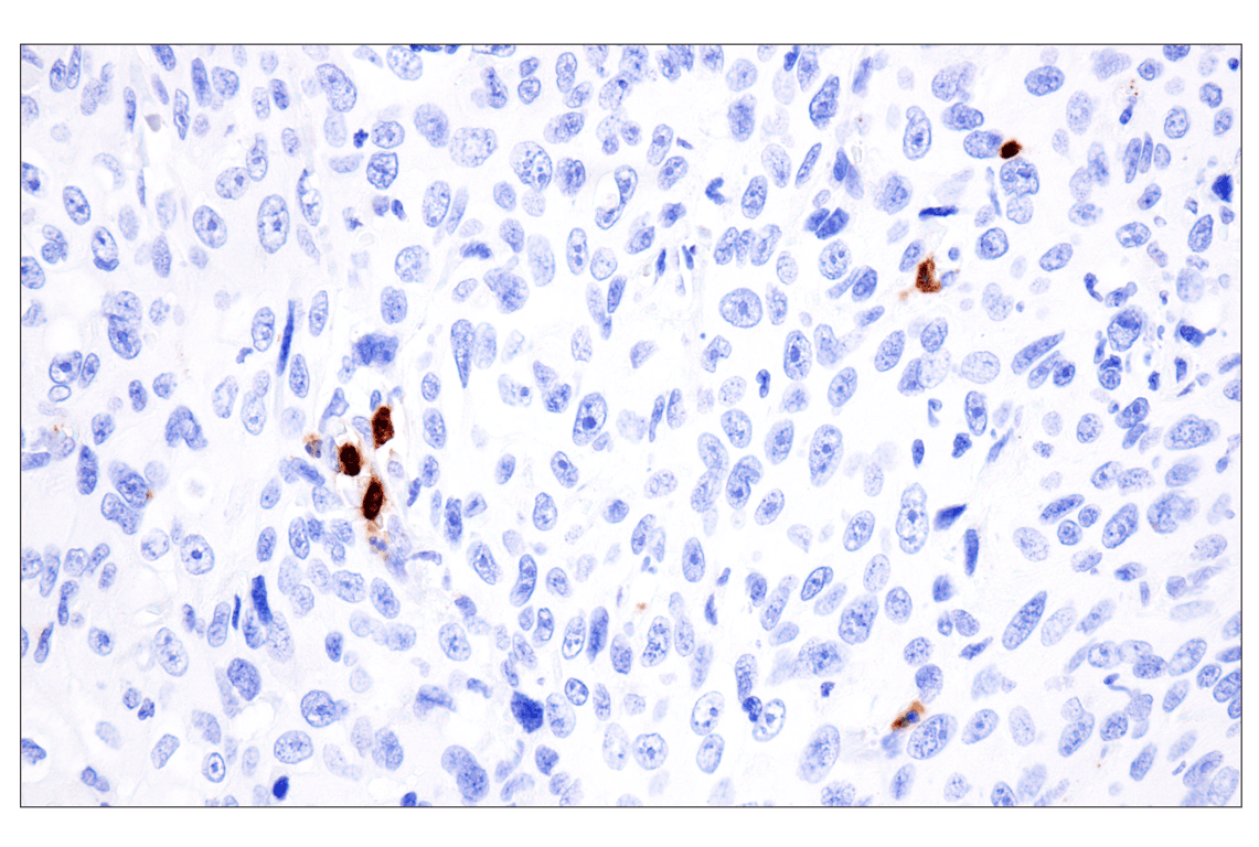 Immunohistochemistry Image 7: CD177 (F9O5U) Rabbit Monoclonal Antibody