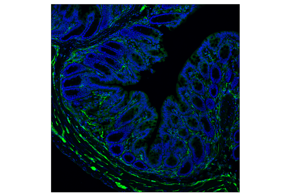Immunofluorescence Image 3: TPPP/p25 (E9C8G) Rabbit Monoclonal Antibody