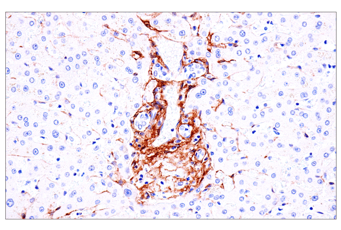 Immunohistochemistry Image 12: p75NTR (E7I3M) Rabbit Monoclonal Antibody (BSA and Azide Free)