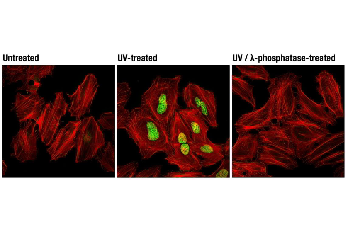 Immunofluorescence Image 1: Phospho-Histone H2A.X (Ser139) (D7T2V) Mouse Monoclonal Antibody