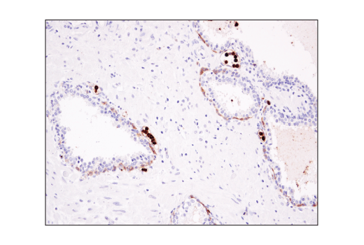 undefined Image 71: Suppressive Myeloid Cell Phenotyping IHC Antibody Sampler Kit