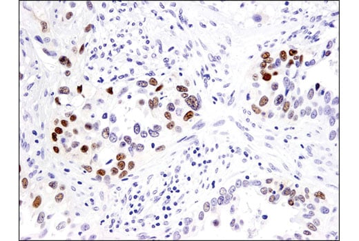 Immunohistochemistry Image 2: Sox9 (D8G8H) Rabbit Monoclonal Antibody