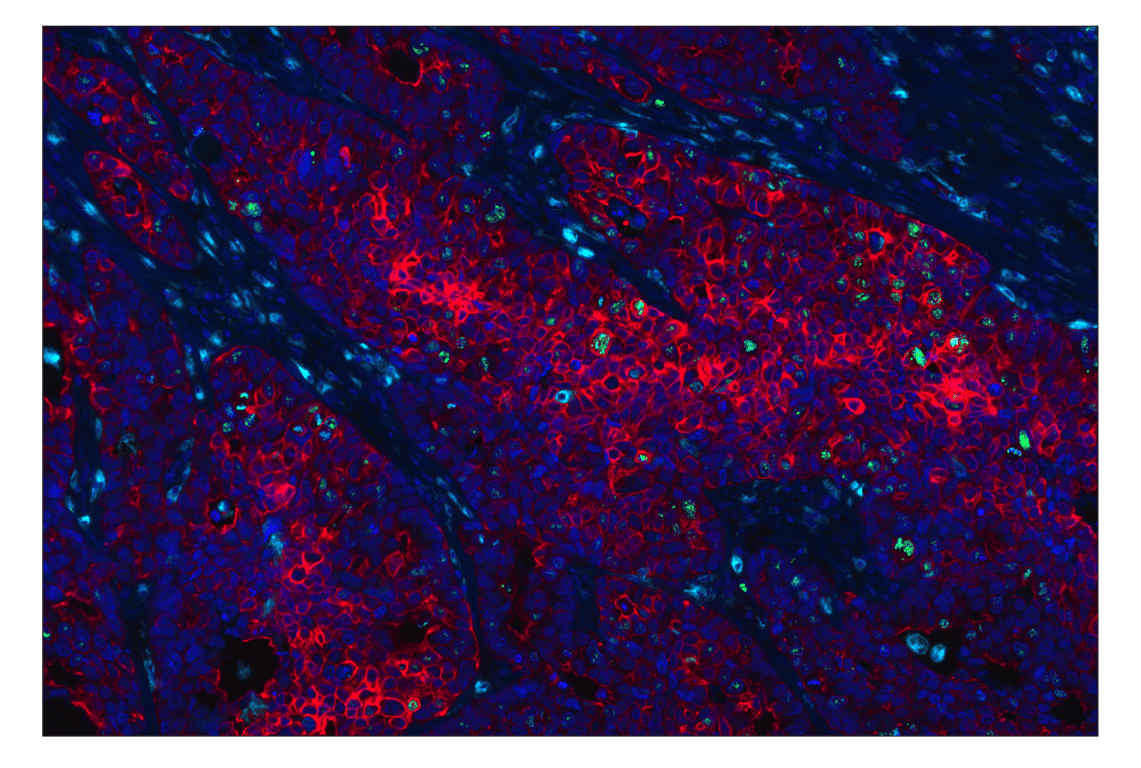 Pan-Keratin MultiMab® Rabbit Monoclonal Antibody mix (Alexa Fluor