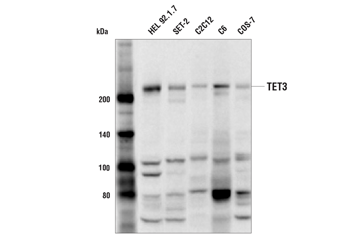 Western Blotting Image 1: TET3 (E6J8A) Rabbit mAb