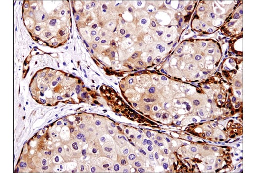 Immunohistochemistry Image 2: YAP (D8H1X) Rabbit Monoclonal Antibody (BSA and Azide Free)