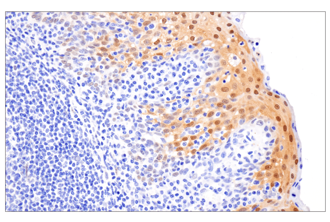 Immunohistochemistry Image 6: Phospho-Stat3 (Ser727) (D4X3C) Rabbit Monoclonal Antibody (BSA and Azide Free)