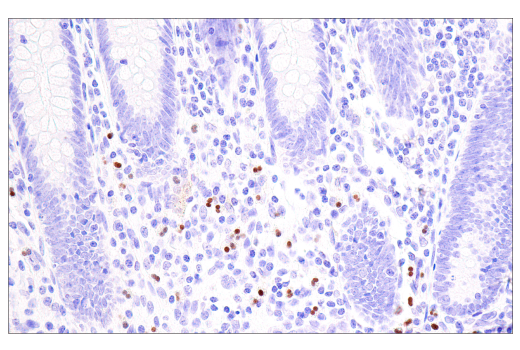 Immunohistochemistry Image 3: Olig2 (E6G6Q) Rabbit Monoclonal Antibody
