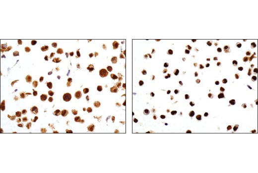 Immunohistochemistry Image 4: Glucocorticoid Receptor (D6H2L) Rabbit Monoclonal Antibody