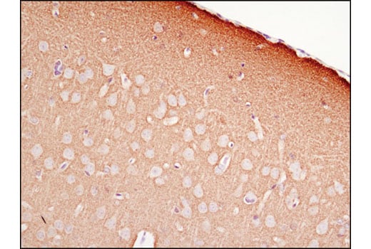 Immunohistochemistry Image 2: Synapsin-1 (D12G5) XP<sup>®</sup> Rabbit mAb