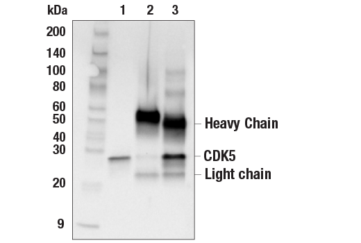 Immunoprecipitation Image 1: CDK5 (D1F7M) Rabbit Monoclonal Antibody
