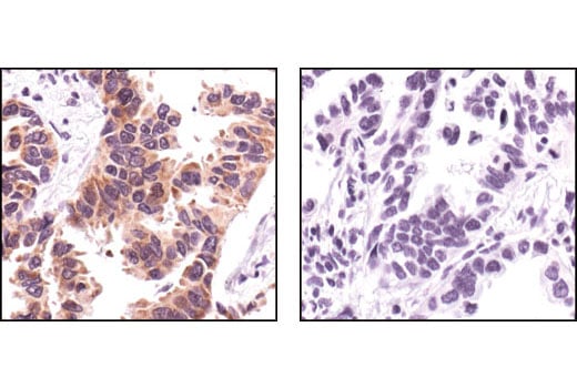 undefined Image 12: Focal Adhesion Protein Antibody Sampler Kit