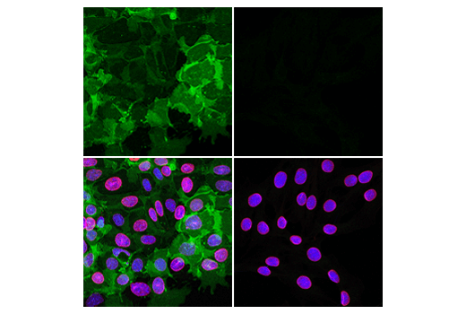 Immunofluorescence Image 1: EpCAM (E8Q1Z) Rabbit Monoclonal Antibody