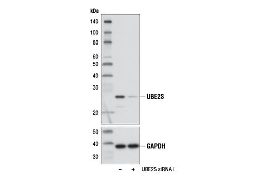 Western Blotting Image 3: UBE2S (D5H9H) Rabbit Monoclonal Antibody