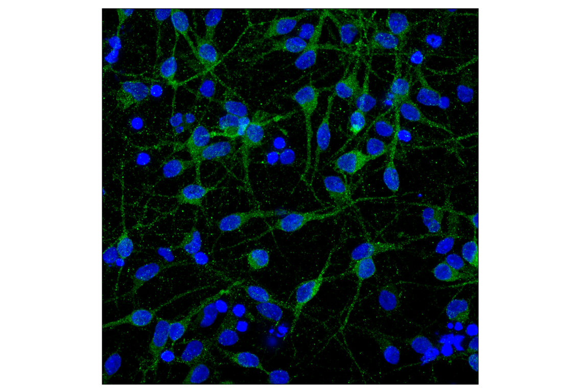 Immunofluorescence Image 1: mGluR5 (D6E7B) Rabbit Monoclonal Antibody