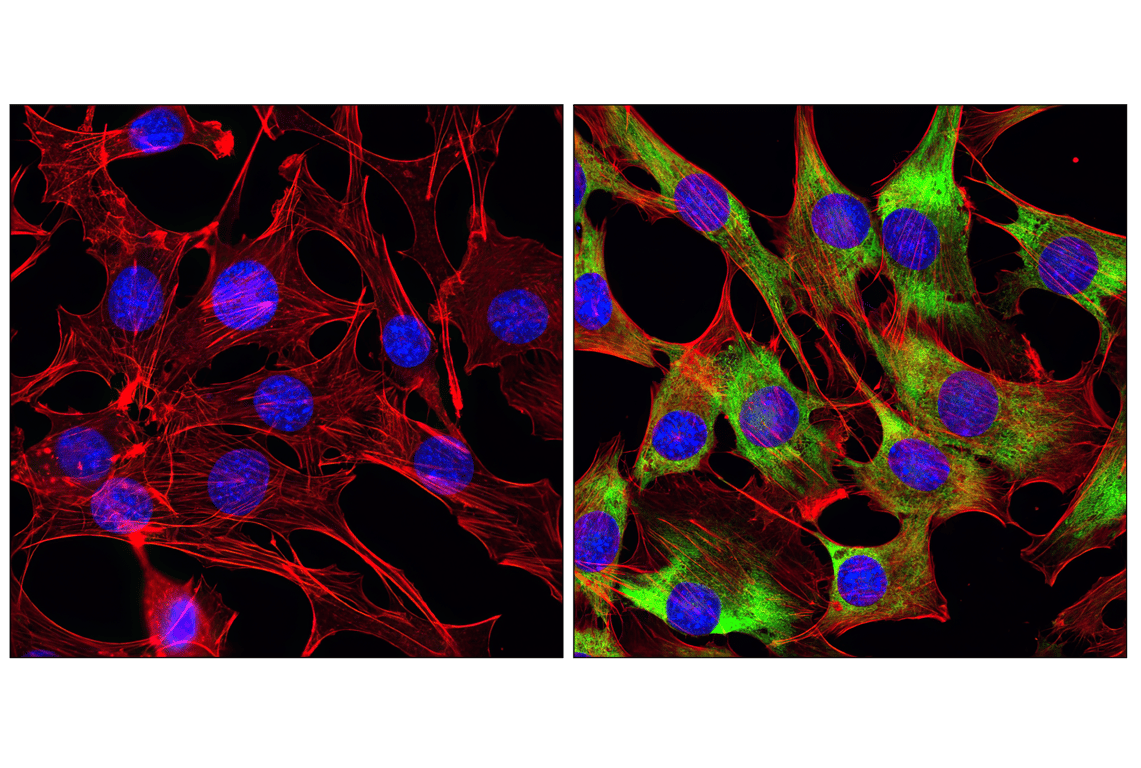Immunofluorescence Image 1: Phospho-S6 Ribosomal Protein (Ser235/236) Antibody