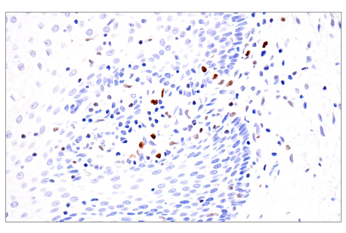 Immunohistochemistry Image 9: BATF3 (E3F3L) Rabbit Monoclonal Antibody