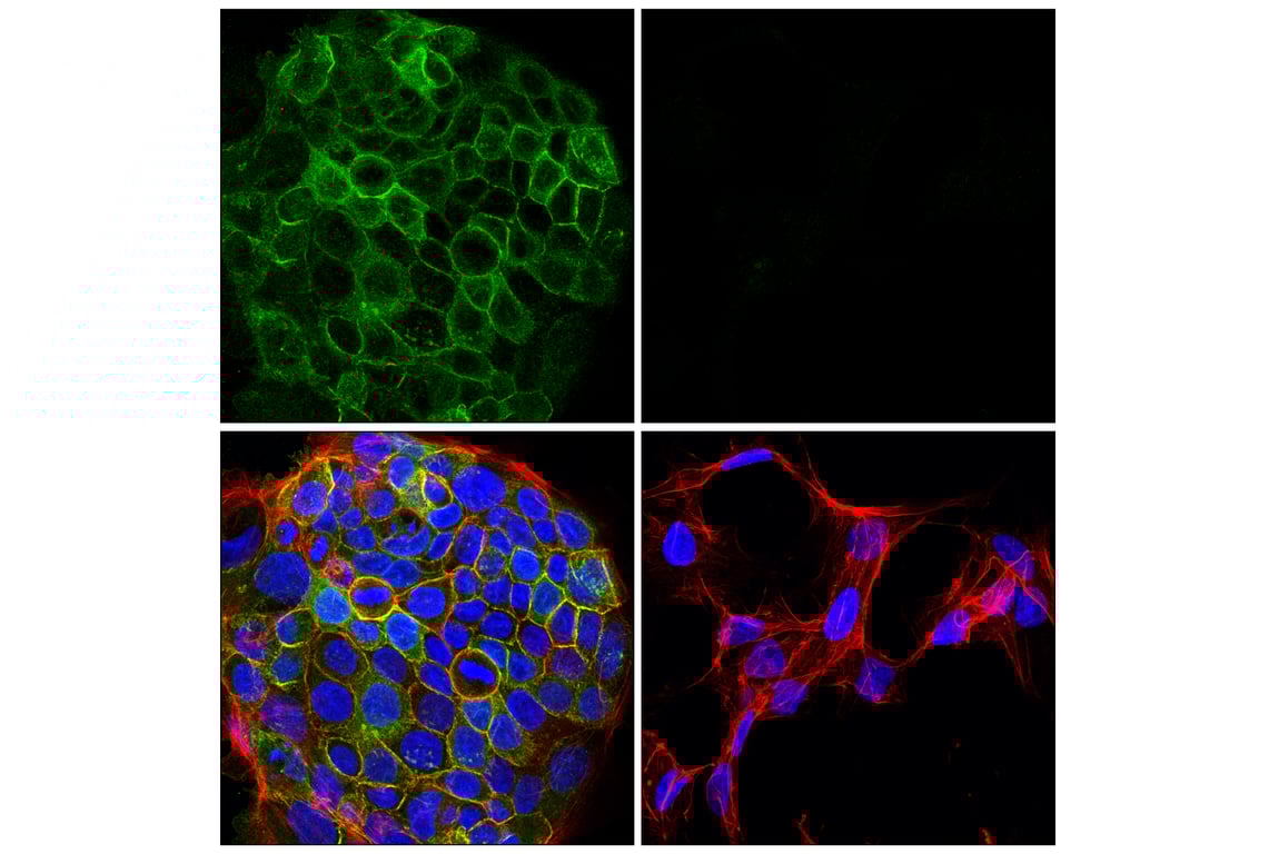 Immunofluorescence Image 1: Integrin beta6 (E4M9P) Rabbit Monoclonal Antibody