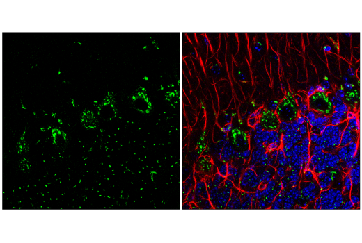 Immunofluorescence Image 2: Furin (E1W4O) Rabbit Monoclonal Antibody