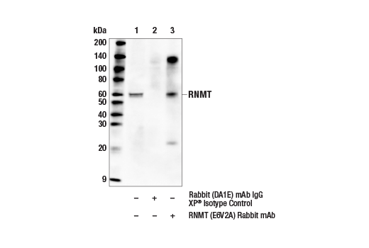 Immunoprecipitation Image 1: RNMT (E6V2A) Rabbit Monoclonal Antibody