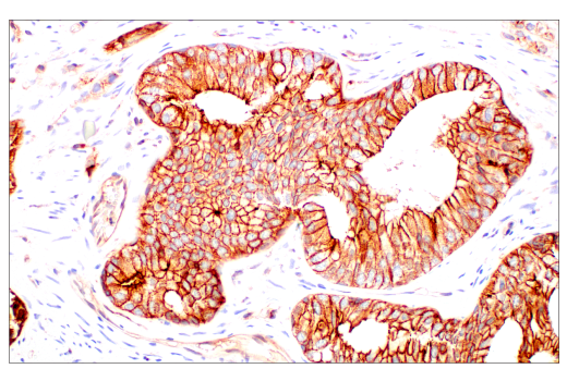 Immunohistochemistry Image 2: JAM-A (E8D2N) Rabbit Monoclonal Antibody