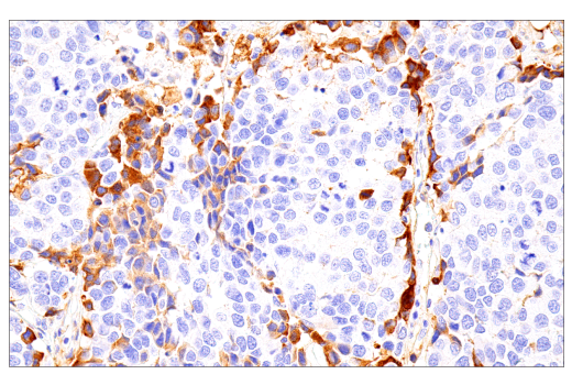 Immunohistochemistry Image 3: IgM (E9U8J) Rabbit Monoclonal Antibody