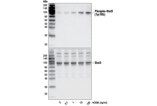 undefined Image 3: Human Oncostatin M (hOSM)