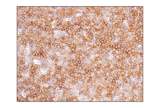 Immunohistochemistry Image 3: CD47 (D3O7P) Rabbit Monoclonal Antibody