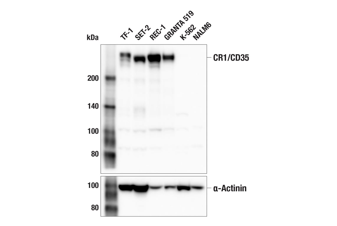 Western Blotting Image 1: CR1/CD35 (E8B1Z) Rabbit mAb